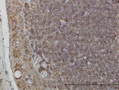 Immunohistochemistry-Paraffin: RNF139 Antibody (3D10) [H00011236-M01]