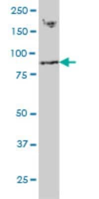 Western Blot: RNF139 Antibody (3D10) [H00011236-M01]