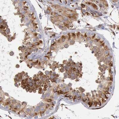 Immunohistochemistry-Paraffin: RNF139 Antibody [NBP1-83212]