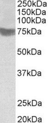 Western Blot: RNF139 Antibody [NBP1-23027]