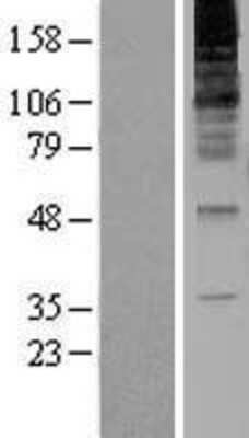 Western Blot: RNF139 Overexpression Lysate [NBL1-15424]