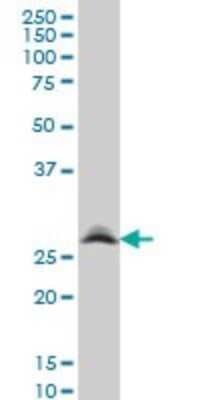 Western Blot: RNF141 Antibody (6D9) [H00050862-M01]