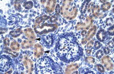 Immunohistochemistry: RNF141 Antibody [NBP3-10331]