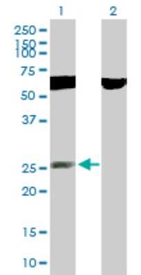 Western Blot: RNF141 Antibody [H00050862-B02P]