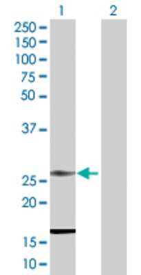 Western Blot: RNF141 Antibody [H00050862-D01P]