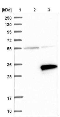 Western Blot: RNF141 Antibody [NBP1-80603]