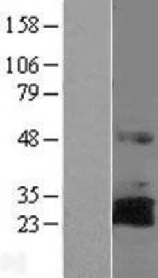 Western Blot: RNF144A Overexpression Lysate [NBL1-15427]