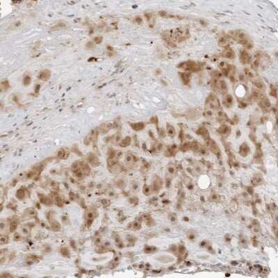 Immunohistochemistry-Paraffin: RNF146 Antibody [NBP1-85319]