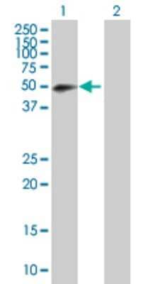 Western Blot: RNF146 Antibody [H00081847-B01P]