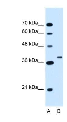 Western Blot: RNF146 Antibody [NBP1-55068]