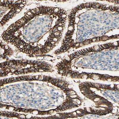 Immunohistochemistry-Paraffin: RNF149 Antibody [NBP1-83440]