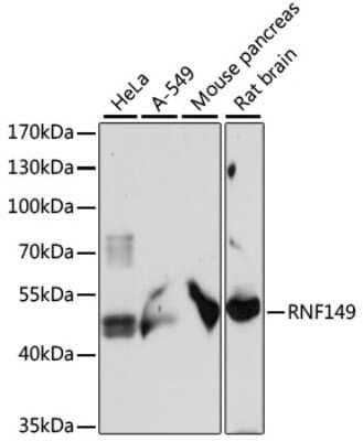 Western Blot: RNF149 AntibodyAzide and BSA Free [NBP2-93343]