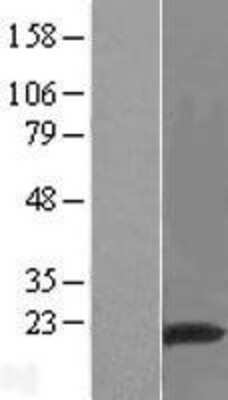 Western Blot: RNF149 Overexpression Lysate [NBP2-05126]