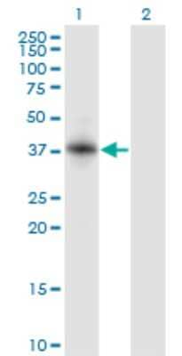 Western Blot: RNF150 Antibody (5D11) [H00057484-M01]