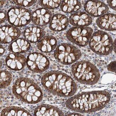 Immunohistochemistry-Paraffin: RNF150 Antibody [NBP1-81429]