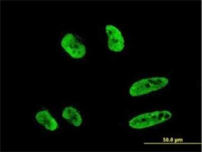 Immunocytochemistry/ Immunofluorescence: RNF151 Antibody (4G8) [H00146310-M02]