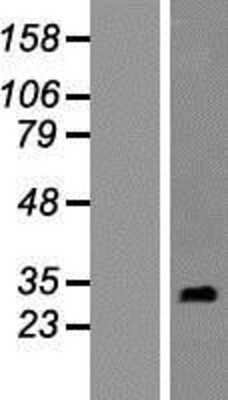 Western Blot: RNF151 Overexpression Lysate [NBP2-05094]