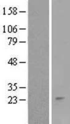 Western Blot: RNF152 Overexpression Lysate [NBL1-15432]