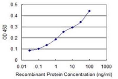 ELISA: RNF157 Antibody (6B3) [H00114804-M01]