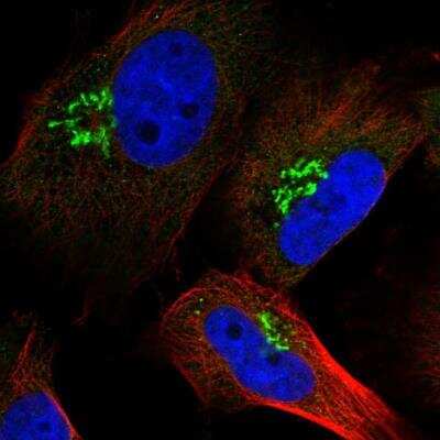 Immunocytochemistry/ Immunofluorescence: RNF157 Antibody [NBP1-81360]