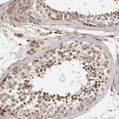 Immunohistochemistry-Paraffin: RNF157 Antibody [NBP1-81360]