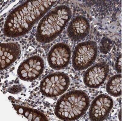 Immunohistochemistry: RNF165 Antibody [NBP2-30675]