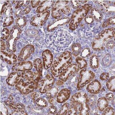 Immunohistochemistry: RNF165 Antibody [NBP2-30720]