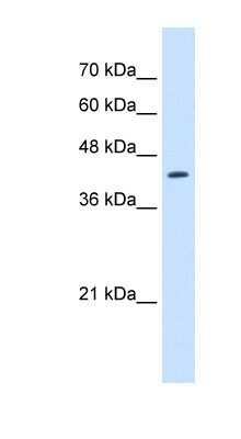 Western Blot: RNF165 Antibody [NBP1-70695]