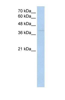 Western Blot: RNF165 Antibody [NBP1-70696]