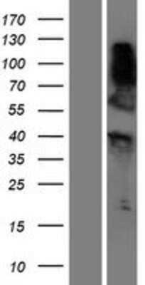 Western Blot: RNF165 Overexpression Lysate [NBP2-05363]