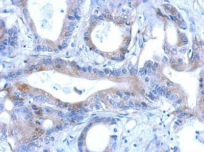 Immunohistochemistry-Paraffin: RNF166 Antibody [NBP2-20177]