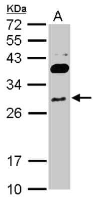 Western Blot: RNF166 Antibody [NBP2-20177]