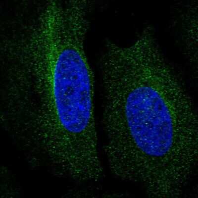 Immunocytochemistry/ Immunofluorescence: RNF167 Antibody [NBP2-30454]