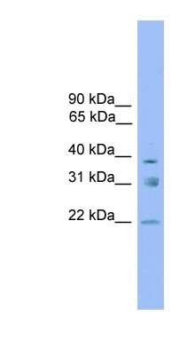 Western Blot: RNF167 Antibody [NBP1-80517]