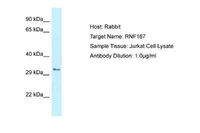 Western Blot: RNF167 Antibody [NBP2-85645]