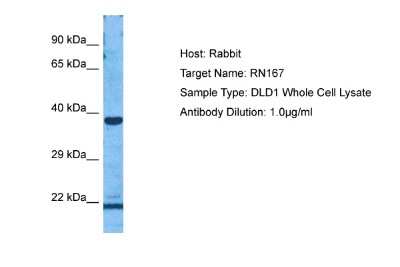 Western Blot: RNF167 Antibody [NBP2-85646]