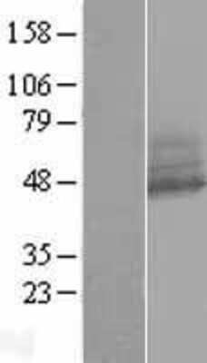 Western Blot: RNF167 Overexpression Lysate [NBP2-07157]