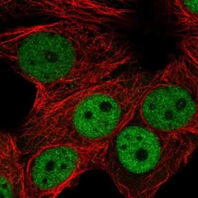 Immunocytochemistry/ Immunofluorescence: RNF168 Antibody [NBP2-54959]