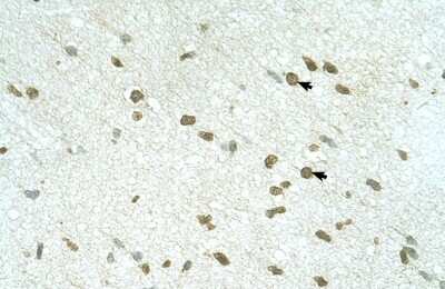 Immunohistochemistry-Paraffin: RNF168 Antibody [NBP1-55075]