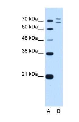 Western Blot: RNF168 Antibody [NBP1-55075]