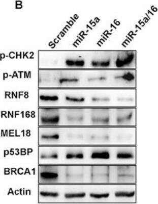 Western Blot: RNF168 AntibodyBSA Free [NBP1-76324]