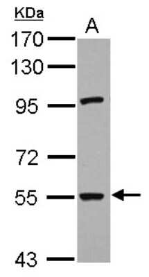 Western Blot: RNF168 Antibody [NBP2-20178]
