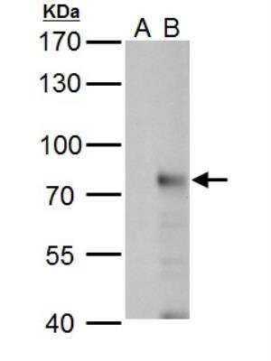 Western Blot: RNF168 Antibody [NBP2-20178]