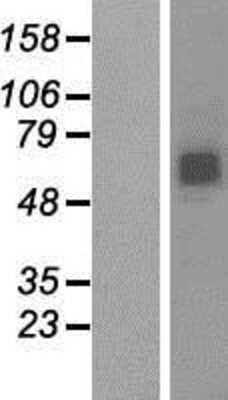 Western Blot: RNF168 Overexpression Lysate [NBP2-05332]