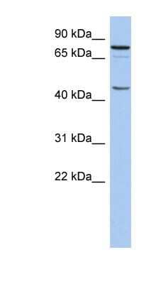 Western Blot: RNF169 Antibody [NBP1-55084]