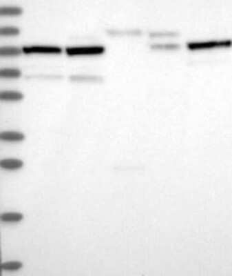 Western Blot: RNF169 Antibody [NBP3-17428]