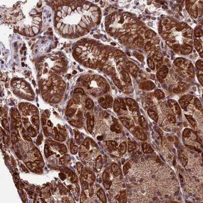 Immunohistochemistry-Paraffin: RNF17 Antibody [NBP1-83782]