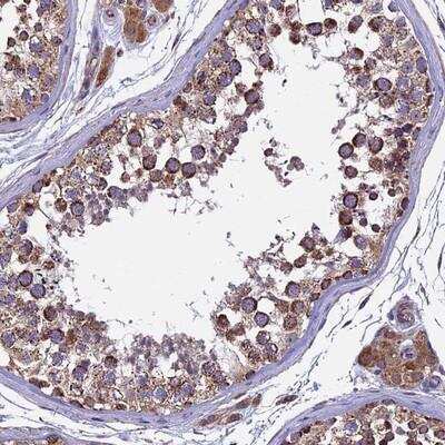 Immunohistochemistry-Paraffin: RNF17 Antibody [NBP1-83783]