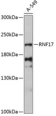 Western Blot: RNF17 AntibodyAzide and BSA Free [NBP2-94677]