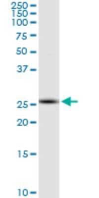 Western Blot: RNF170 Antibody (2D6) [H00081790-M01]